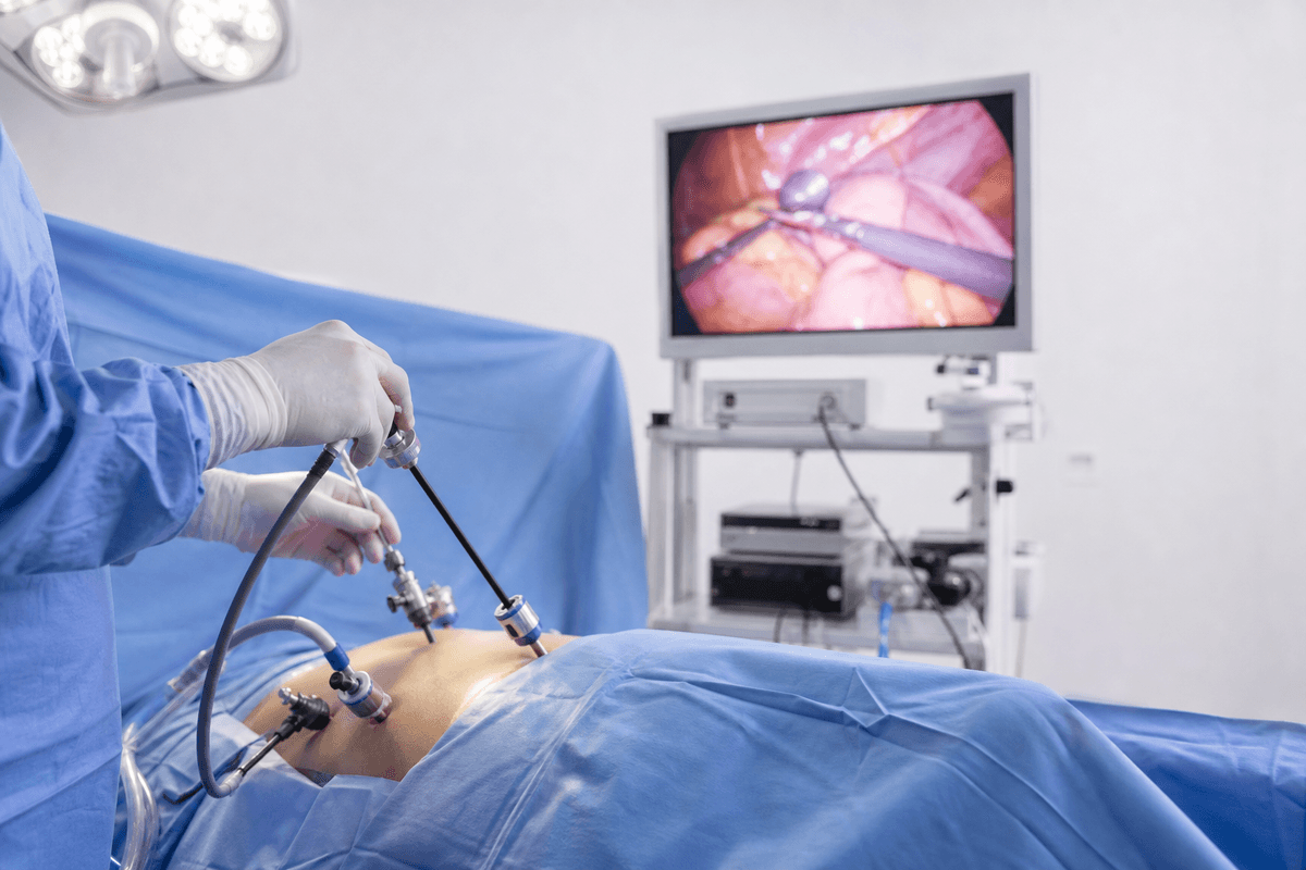 Intestinal Obstruction Surgery