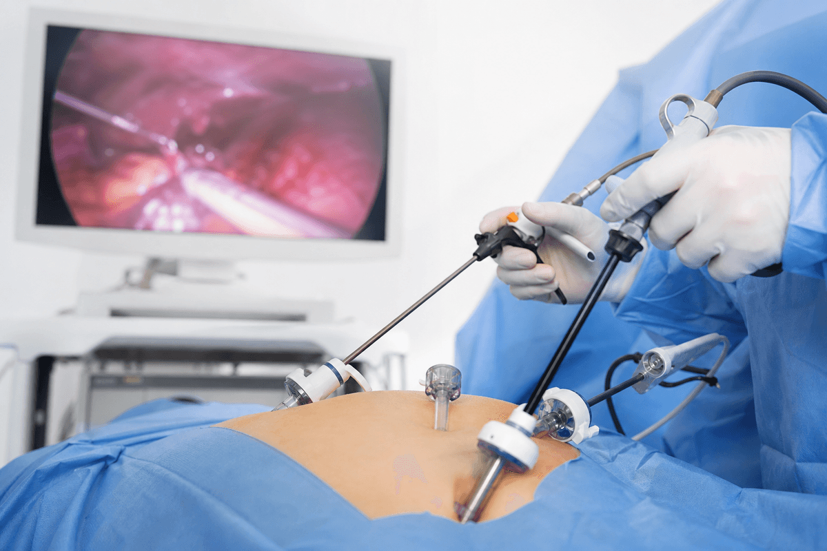 Complex Gallbladder Surgery