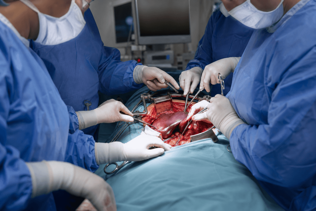 Liver Transplantation