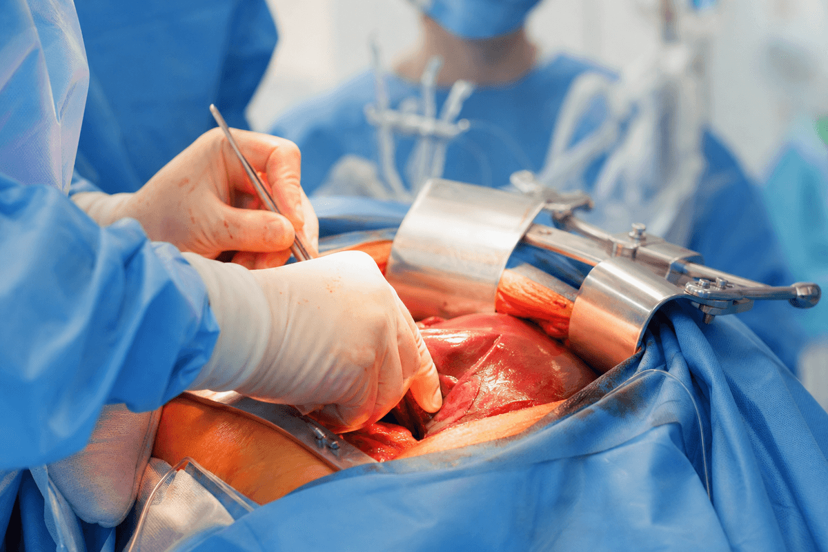 Liver Surgery