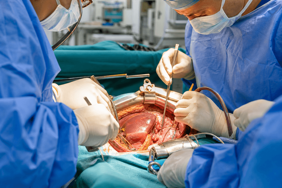 Hepatobiliary Cancer Surgery