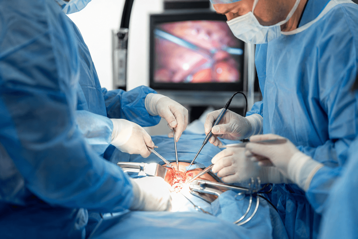 Complex Abdominal Surgery